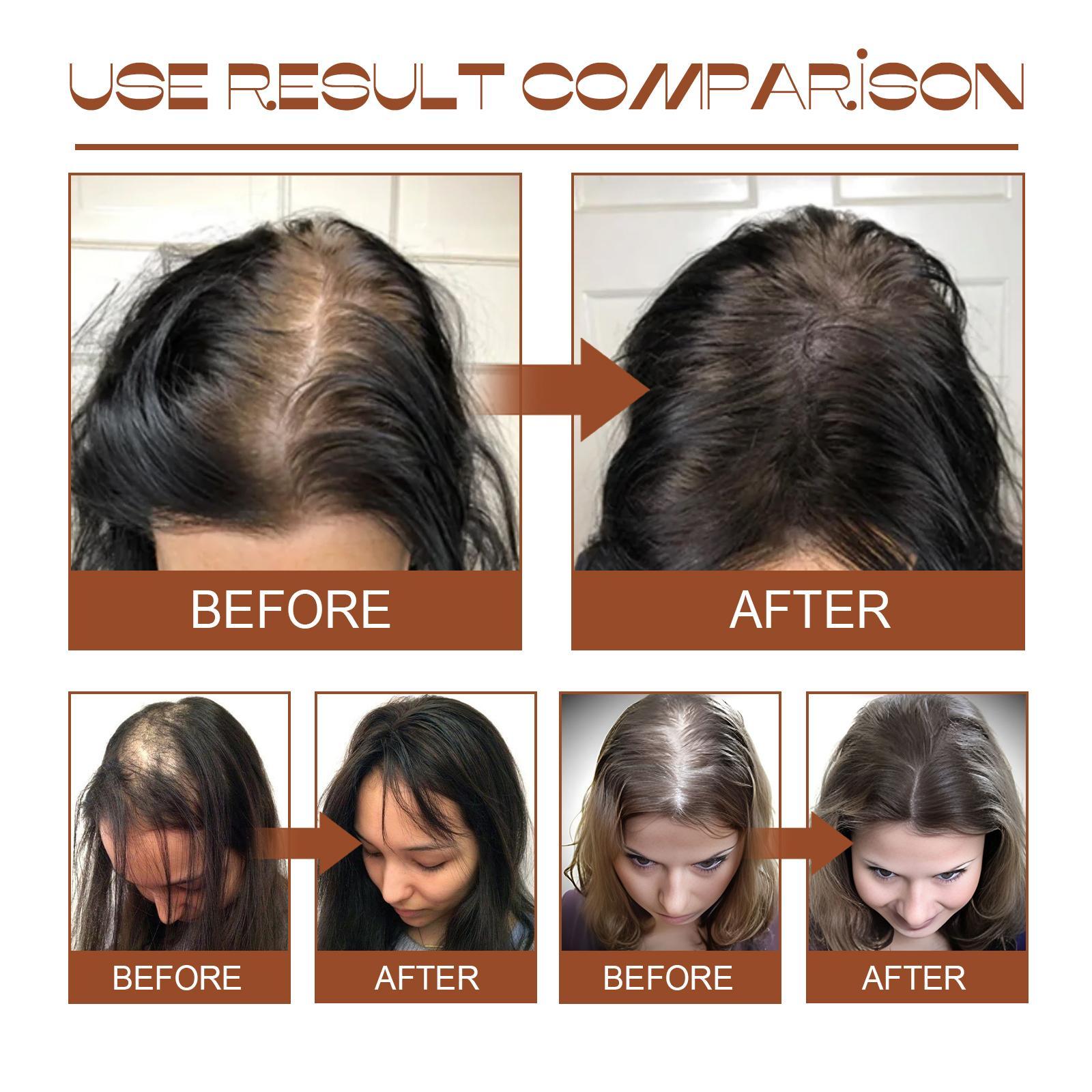 Batana Oil From Honduras - Get Fuller, Thicker, Healthier Hair - Image 5